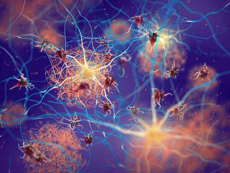 Read: Biden Administration Must Follow the Science By Expanding Access to Alzheimer’s Innovation