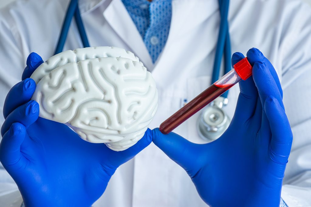 Read: Change in Epidemiology of Creutzfeldt-Jakob Disease in the US, 2007-2020