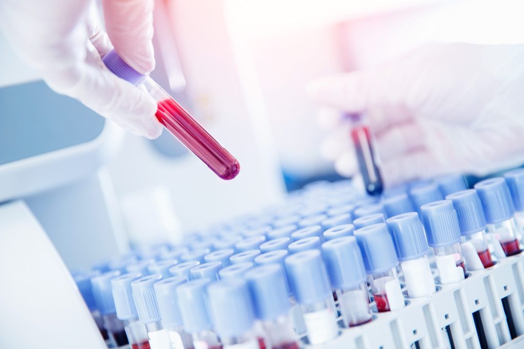 Read: Considerations in the Implementation of Multicancer Early Detection Tests