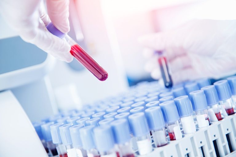 Read: Considerations in the Implementation of Multicancer Early Detection Tests