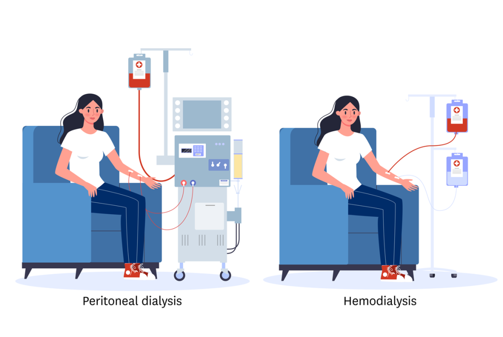 Read: Challenging Assumptions of Outcomes and Costs Comparing Peritoneal and Hemodialysis