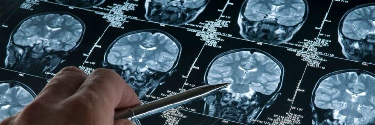 Read: Are We Ready to Treat Alzheimer’s?