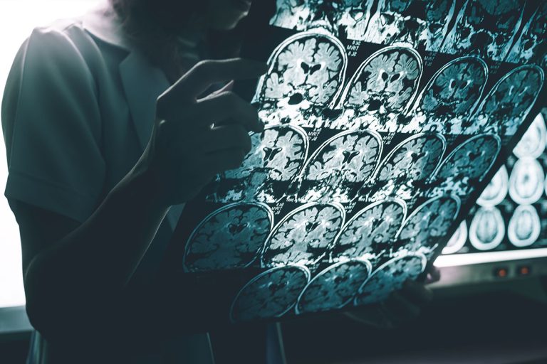 Read: Does Adding MRI and CSF-Based Biomarkers Improve Cognitive Status Classification Based on Cognitive Performance Questionnaires?