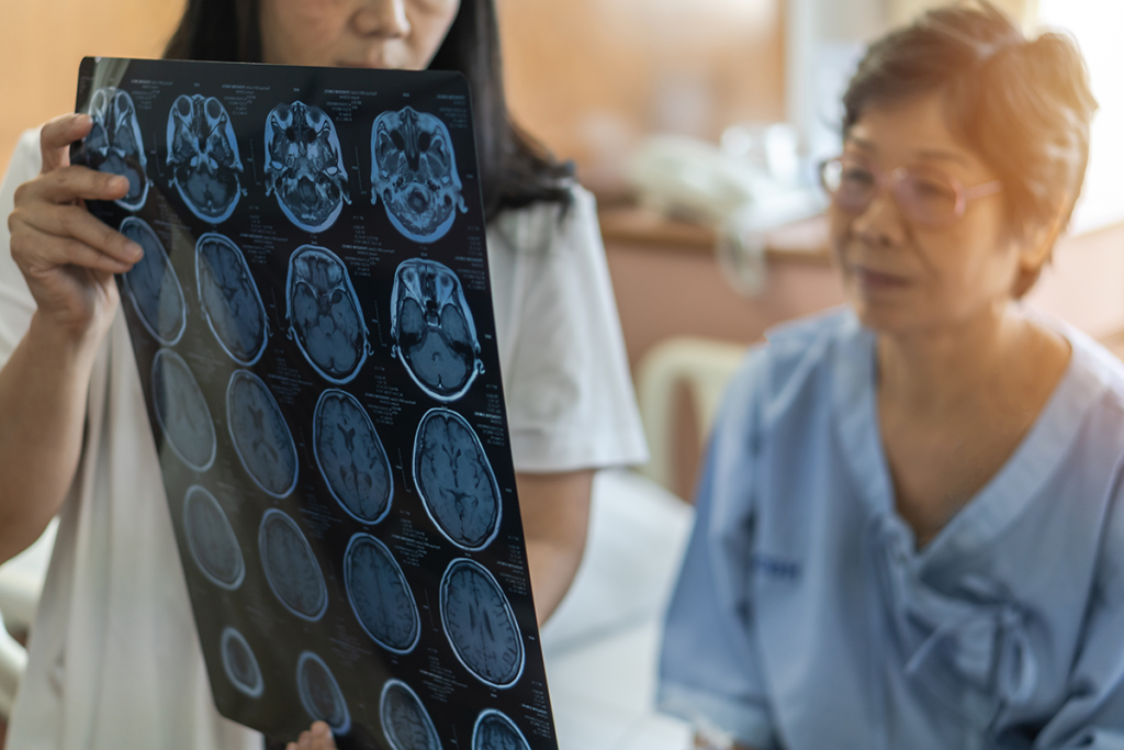 Read: Trends in Incident Dementia Diagnosis Before and After Medicare Risk Adjustment