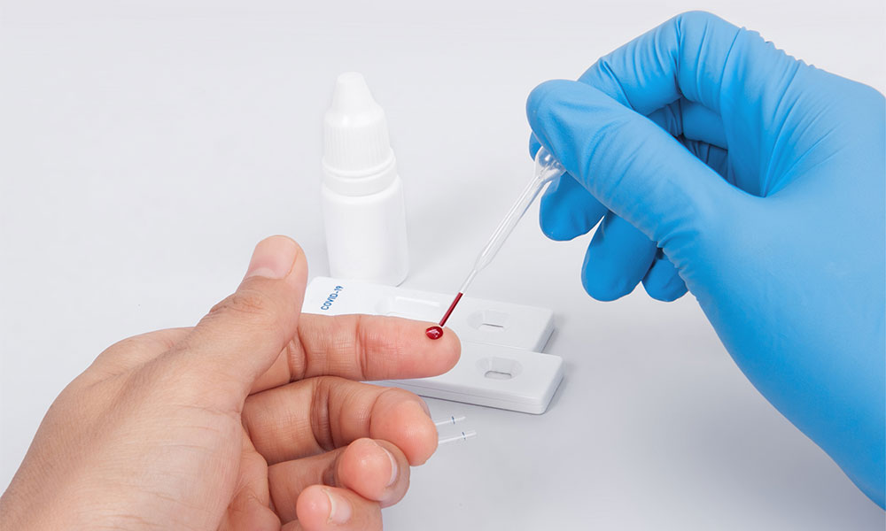 Read: Financial Incentives and Social Messaging for Repeat SARS-CoV-2 Antibody Testing Among the Underserved: A Randomized Trial